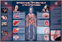Электрифицированный стенд "Вредные привычки: алкоголизм" - «globural.ru» - Новоуральск