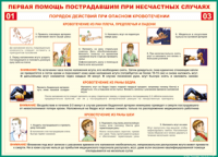 Таблица Порядок действий при опасном кровотечении 1000*1400 винил - «globural.ru» - Новоуральск